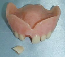 denture repair2